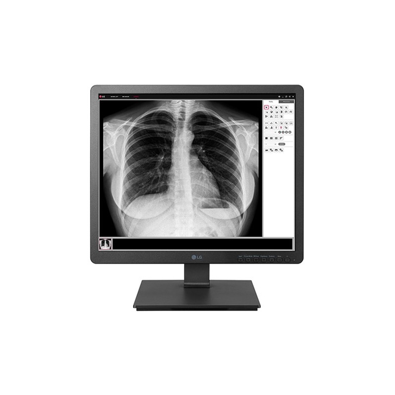 LG 19HK312C-B - 19" - 1280x1024 - SXGA Negro
