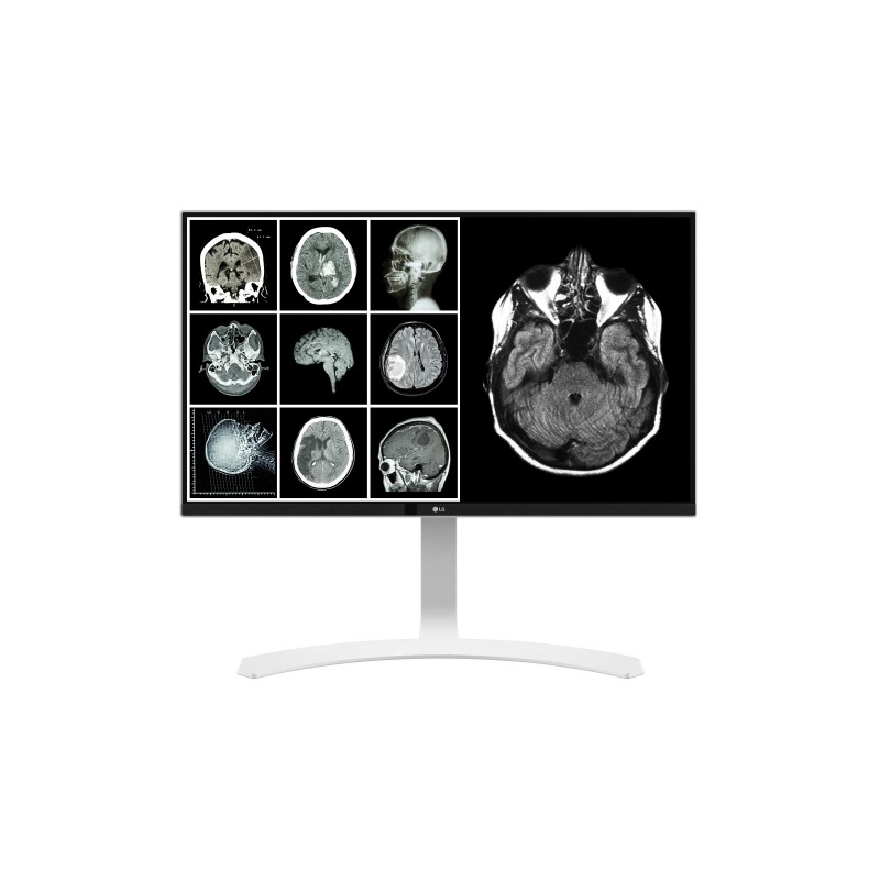 LG 27HJ712C-W - 27" 4K Ultra HD - LED - Blanco
